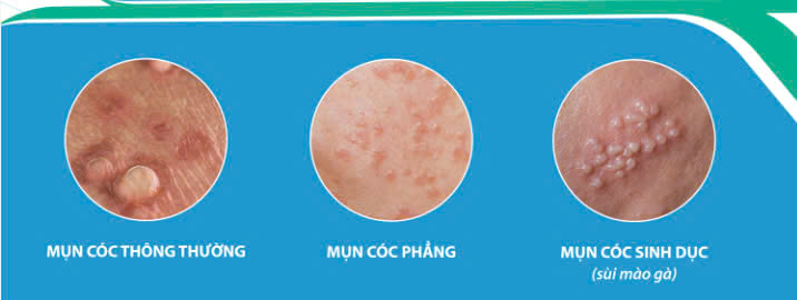 Block Image